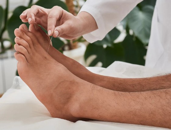 Acupuntura en Bogotá-Euritmia