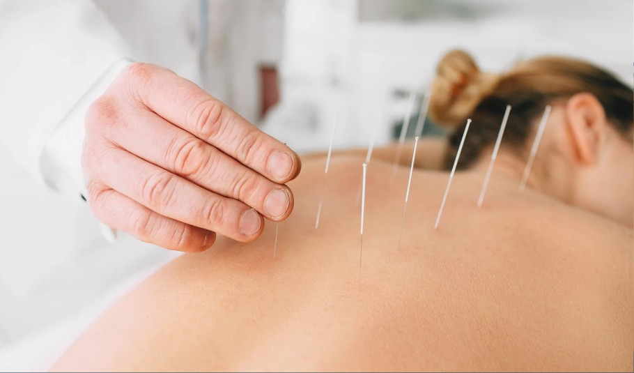 Acupuntura en Bogotá-Euritmia