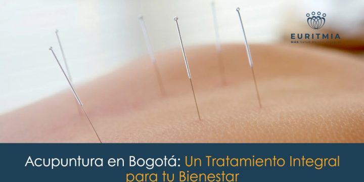 Acupuntura en Bogotá: Un Tratamiento Integral para tu Bienestar