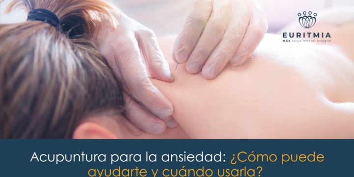 ¿Cómo puede ayudarte la acupuntura para la ansiedad y cuándo usarla?